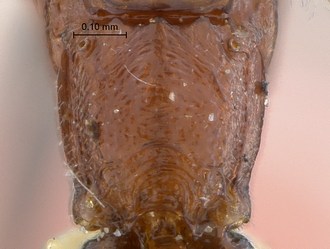 Heterischnus olsoufieffi propodeum