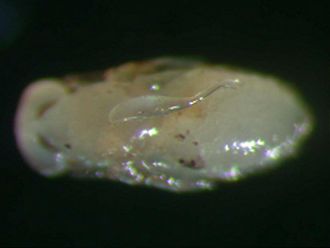 Aprostocetus_exertus_egg_on_gall-wasp_pupa