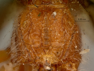 Cremnops_zululandensis_SAM-HYM-P002226_propodeum_dorsal