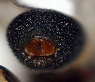 Chelonus_M_madagaskariensis_metasoma_apical
