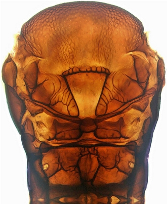 Apanteles_minatchy_mesosoma_KOH