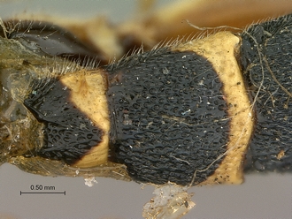 Metopius_albo-ornatus_SAM-HYM-P001520_segments_metasoma_dorsal