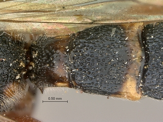 Metopius_apertus_SAM-HYM-P001521_segments_metasoma_dorsal