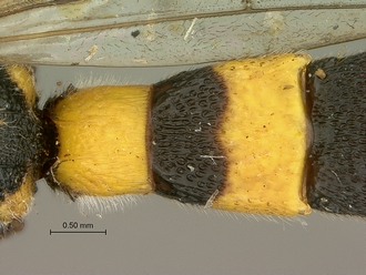 Metopius_strenuus_SAM-HYM-P001554_segments_metasoma_dorsal