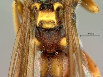 Metopius_zuluanus_SAM-HYM-P001555_propodeum_dorsal