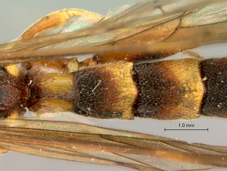 Metopius_zuluanus_SAM-HYM-P001555_segments_metasoma_dorsal