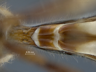 Epirhyssa_brianfisheri_SAM-HYM-P048018_sternite1