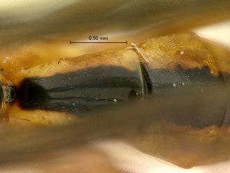 Phytodietus_sp_SAM-HYM-P000289_1&2_segments_metasoma_dorsal