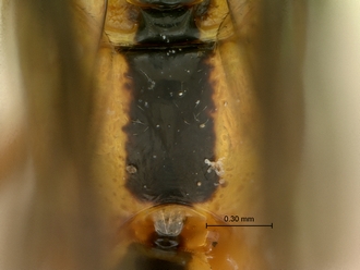 Phytodietus_sp_SAM-HYM-P000289_propodeum_dorsal
